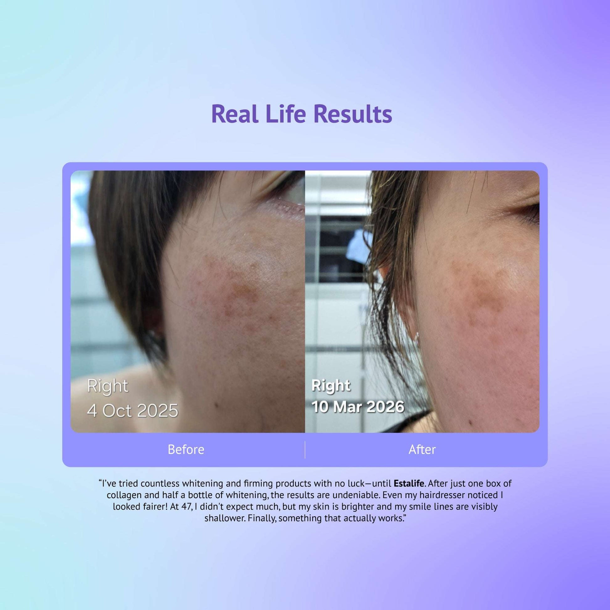 Estalife Collagen Peptides 6600MG | Vitamin C + Whitening Glutathione Estalife.com Estalife Collagen Peptides 6600MG | Vitamin C + Whitening Glutathione Estalife.com