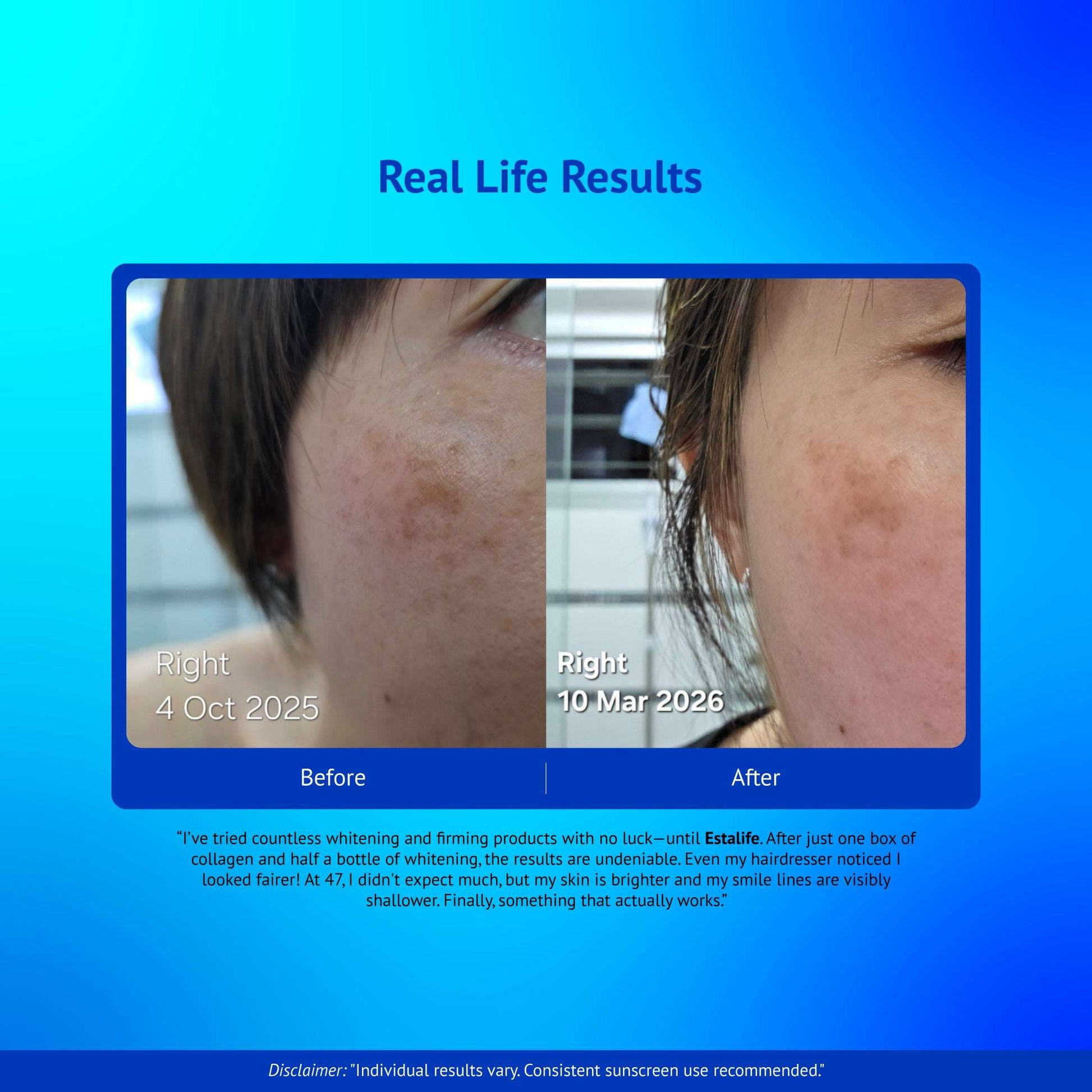 glutathione lotion price lio cosmeds LC Gluta Glutathione Body Lotion Price in India glutathione lotion price lio cosmeds LC Gluta Glutathione Body Lotion Price in India