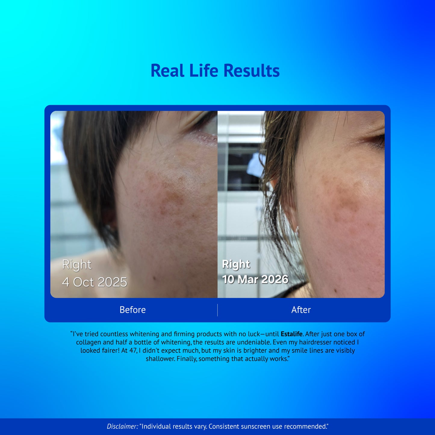 Estalife Whitening Glutathione 500MG | Skin Supplement | Brightening | Liver | 60 Capsule